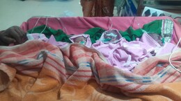 Chhindwara News: छिंदवाड़ा में महिला ने एक साथ 4 बच्चों को दिया जन्म,  चमत्कारिक रूप से सभी नवजात हैं सुरक्षित