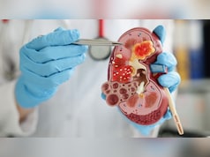 World Kidney Day 2026: डायबिटीज और हाई ब्लड प्रेशर कैसे चुपचाप किडनी को पहुंचाते हैं नुकसान