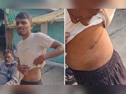 किसान ने लिया एक लाख का कर्ज, साहूकार ने सूद के साथ 74 लाख बना दिया, विदेश ले जाकर निकलवा ली किडनी