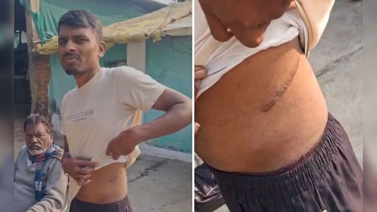 किसान ने लिया एक लाख का कर्ज, साहूकार ने सूद के साथ 74 लाख बना दिया, विदेश ले जाकर निकलवा ली किडनी