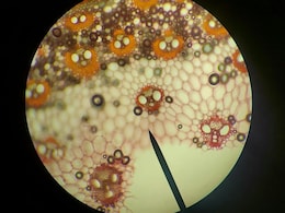 New Experimental Obesity Drugs Target Mitochondria To Burn More Calories: Australian Study