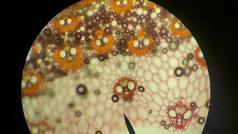 New Experimental Obesity Drugs Target Mitochondria To Burn More Calories: Australian Study