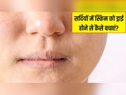 सर्दियों में रूखी होकर फटने लगती है स्किन? डर्मेटोलॉजिस्ट ने बताया क्या करने से दिखेगी सॉफ्ट और ग्लोइंग