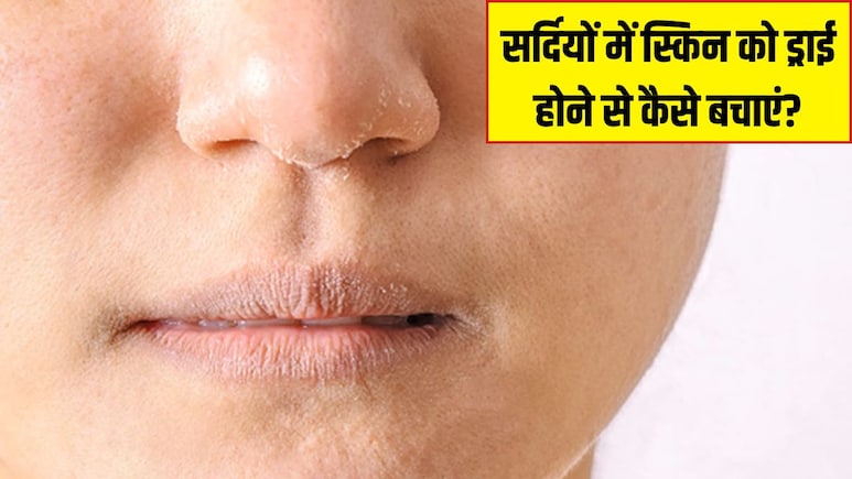 सर्दियों में रूखी होकर फटने लगती है स्किन? डर्मेटोलॉजिस्ट ने बताया क्या करने से दिखेगी सॉफ्ट और ग्लोइंग