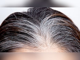 इन 4 कारणों की वजह से उम्र से पहले सफेद हो जाते हैं बाल, डर्मेटोलॉजिस्ट ने बताया तीसरा कारण है सबसे आम