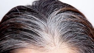 इन 4 कारणों की वजह से उम्र से पहले सफेद हो जाते हैं बाल, डर्मेटोलॉजिस्ट ने बताया तीसरा कारण है सबसे आम