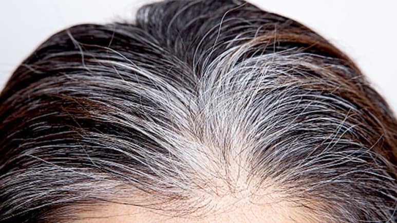इन 4 कारणों की वजह से उम्र से पहले सफेद हो जाते हैं बाल, डर्मेटोलॉजिस्ट ने बताया तीसरा कारण है सबसे आम