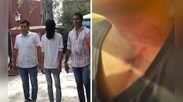 Suspicious Of Wife's Affair, Mumbai Man Slits Sleeping Daughter's Throat