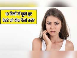 फूला-फूला दिख रहा है चेहरा? डर्मेटोलॉजिस्ट ने बताया चेहरे की सूजन को 10 दिनों में कम कैसे करें