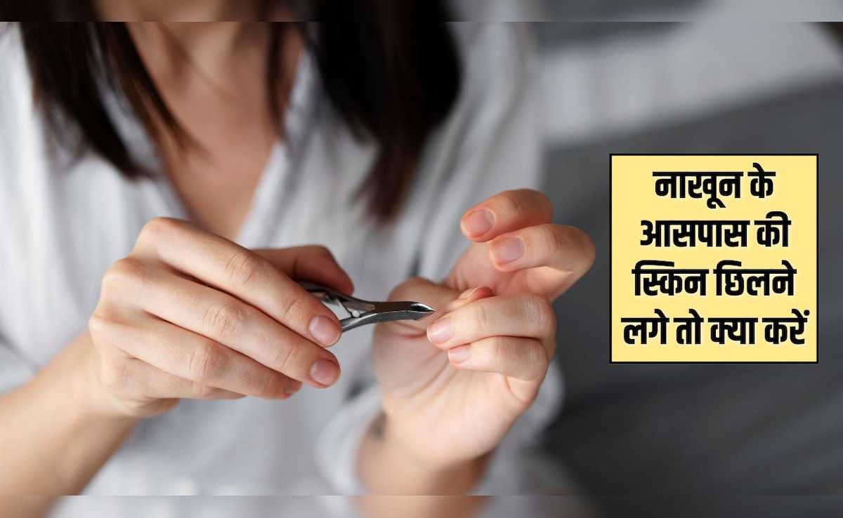 नाखूनों के आसपास वाली त्वचा छिलने लगे तो क्या करें? ये रही आसान टिप्स, मुलायम हो जाएगी स्किन
