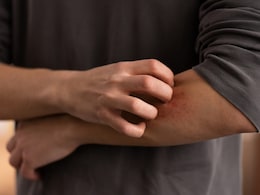 Mosquito Myths That Need To Buzz Off: What Really Spreads Dengue And Malaria