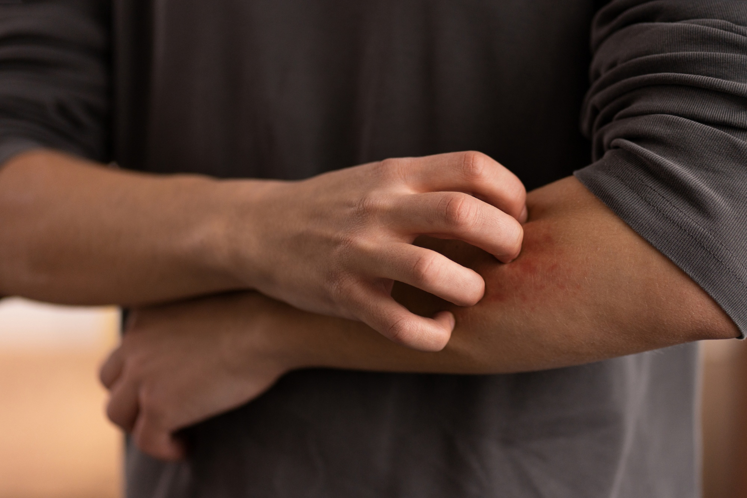 Mosquito Myths That Need To Buzz Off: What Really Spreads Dengue And Malaria