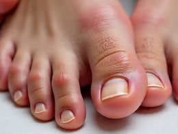 सर्दियों में मेरे पैर की उंगलियां लाल क्यों हो जाती हैं? जानें कारण, लक्षण और बचाव