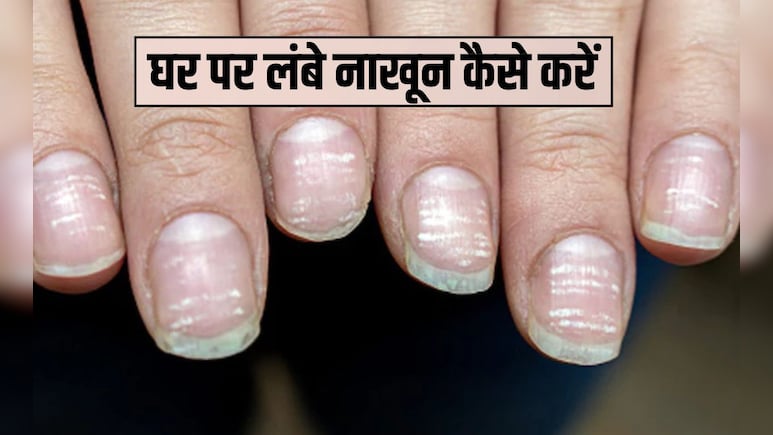 1 हफ्ते में तेजी से नाखून कैसे बढ़ाएं? तेजी से नाखून बढ़ाने के लिए क्या करें, यह रगड़ना कर दें शुरू फ‍िर देखें रि‍जल्‍ट