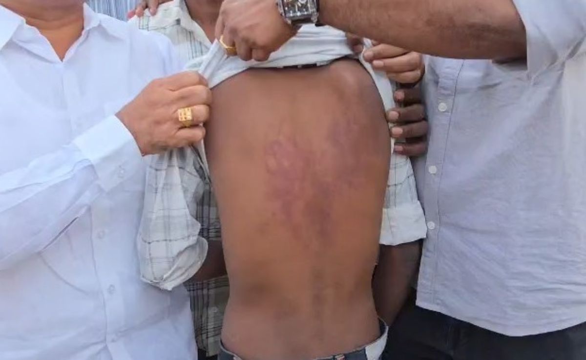 Class 7 Student Beaten With Sticks By Class 10 Boys. Principal Wanted It