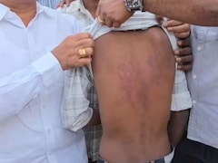 Class 7 Student Beaten With Sticks By Class 10 Boys. Principal Wanted It