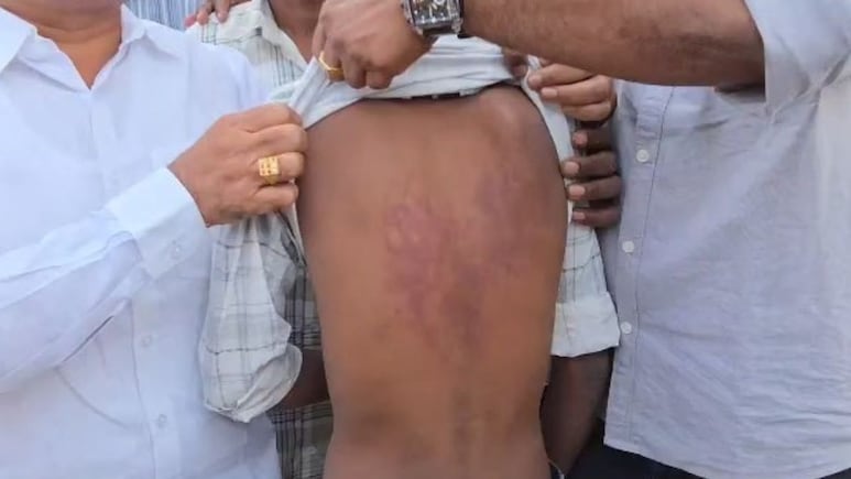 In Hyderabad, Principal Orders Class 10 Students To Thrash Class 7 Boy