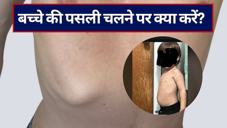 बच्चे की पसली चलने पर क्या करें? बच्चे की पसली चलने पर हो सकती हैं ये गंभीर बीमारियां, इन 4 तरीकों से मिलेगी राहत