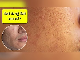 Open Pores Home Remedies: चेहरे पर गड्ढे कैसे खत्म करें? चेहरे के गड्ढे भरने के लिए 5 आसान तरीके