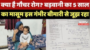 Barwani News : क्या है Gaucher Disease? बड़वानी का 5 साल का Bilal इस गंभीर बीमारी से जूझ रहा