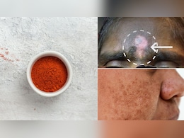 क्या सिंदूर लगाने से भी झाइयां बढ़ती हैं? स्किन की डॉक्टर से जानें माथे और मांग में सिंदूर लगाने से क्या होता है