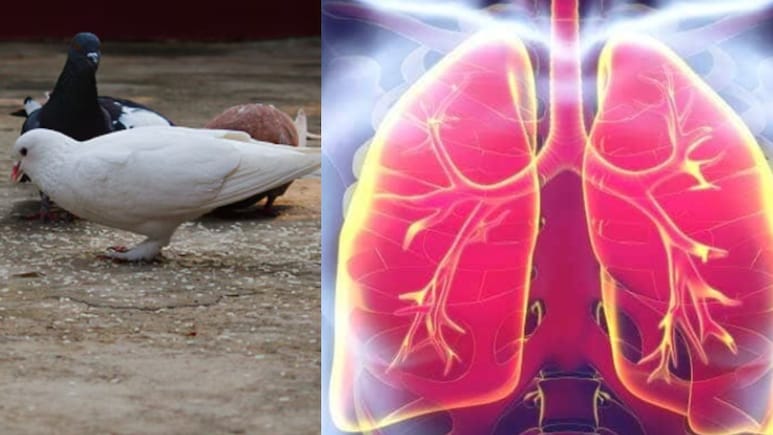 कबूतरों को दाना डालना बन सकता है जानलेवा! डॉक्टर ने बताया होती है फेफड़ों की ये खतरनाक बीमारी