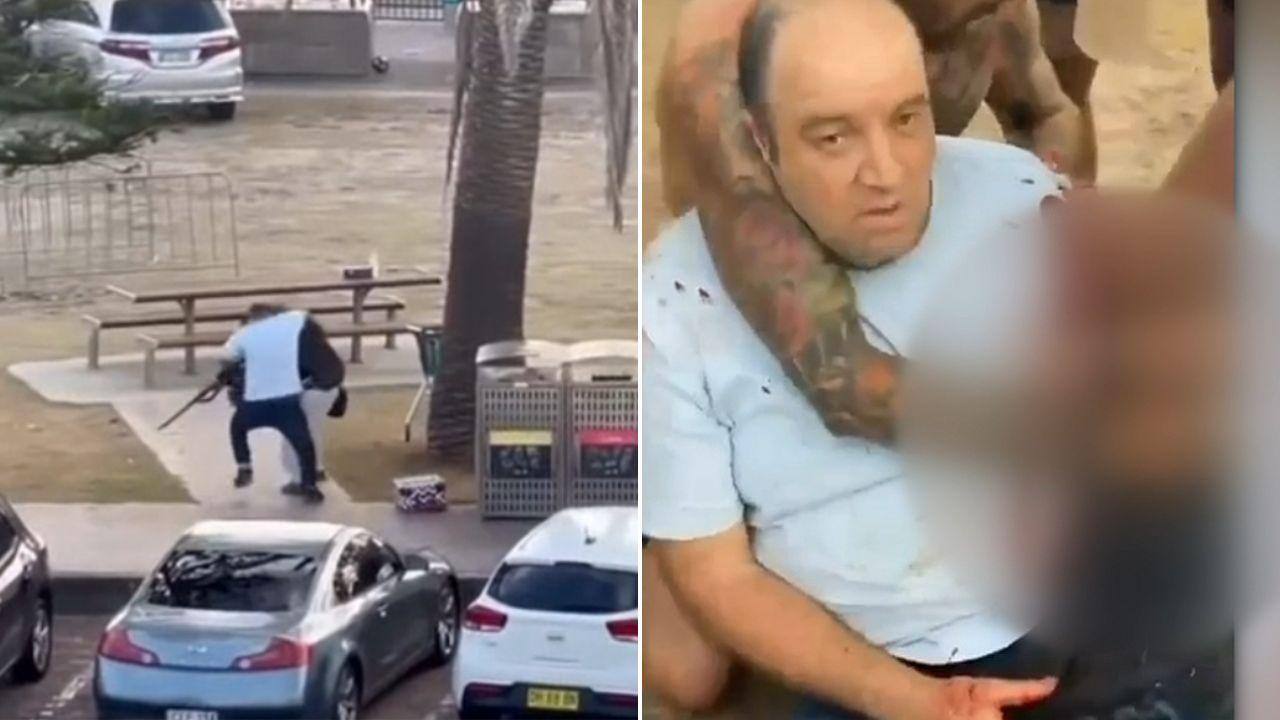 "Would Do It Again": Man Who Snatched Gun From Sydney Shooter May Lose Arm