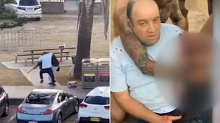 "Would Do It Again": Man Who Snatched Gun From Sydney Shooter May Lose Arm