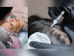 Can The Viral Exosome Therapy Really Cure Hair Fall And Reverse Ageing? What Science Says