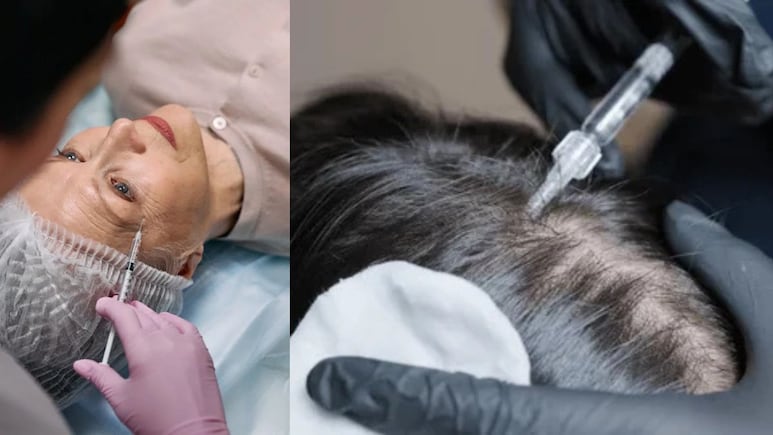 Can The Viral Exosome Therapy Really Cure Hair Fall And Reverse Ageing? What Science Says