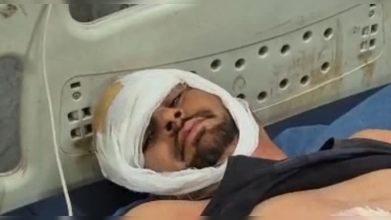 पुल‍िस की गाड़ी 112 पर फायर‍िंग, ड्राइवर के पेट में लगी गोली