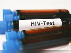 HIV Symptoms : क्यों और कैसे फैलता है AIDS, यहां जानिए लक्षण और उपचार