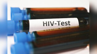 HIV Symptoms : क्यों और कैसे फलता है AIDS, यहां जानिए लक्षण और उपचार