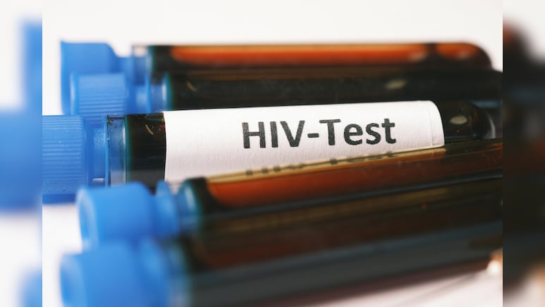 HIV Symptoms : क्यों और कैसे फैलता है AIDS, यहां जानिए लक्षण और उपचार