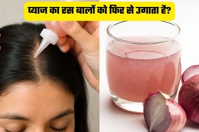 क्या सच में प्याज का रस लगाने से गंजी खोपड़ी पर भी निकल आते हैं बाल? जानिए कैसे करना है इस्तेमाल