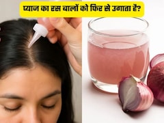क्या सच में प्याज का रस लगाने से गंजी खोपड़ी पर भी निकल आते हैं बाल? जानिए कैसे करना है इस्तेमाल