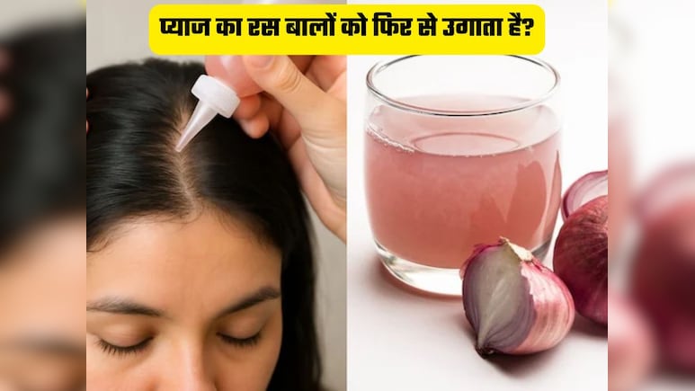 क्या सच में प्याज का रस लगाने से गंजी खोपड़ी पर भी निकल आते हैं बाल? जानिए कैसे करना है इस्तेमाल