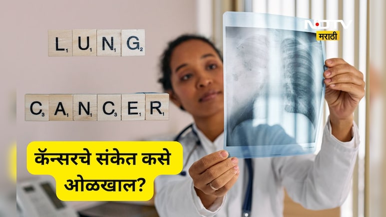 Lungs Cancer: खोकला येण्यापूर्वीच 'या' दोन गोष्टी देतात कॅन्सरचे संकेत, वेळीच ओळखा नाहीतर  होईल घात