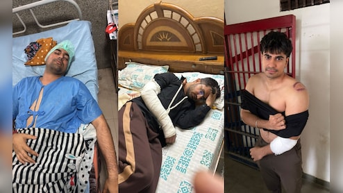 जयपुर के क्लब में पार्टी कर रहे MBBS छात्रों को बाउंसर्स ने बुरी तरह पीटा, 10 घायल; डीजे को लेकर हुआ विवाद