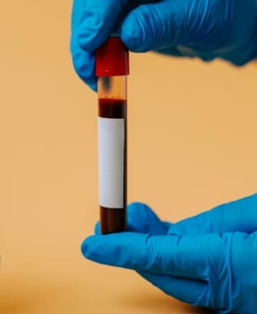 Best Foods To Improve Haemoglobin Levels