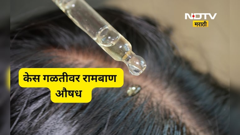 Onion Juice Benefits: केसगळतीवर घरगुती उपाय काय? कांद्याचा रस खरोखरच प्रभावी आहे का? जाणून घ्या तज्ज्ञांचे मत