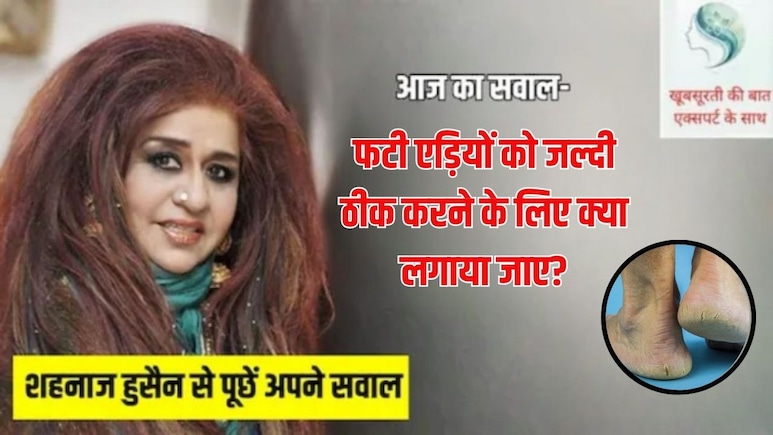 आज का सवाल- मेरे पैरों की एड़ियां फट गई हैं, क्या घर पर कोई आसान होम रेमेडी बनाकर लगा सकती हूं?