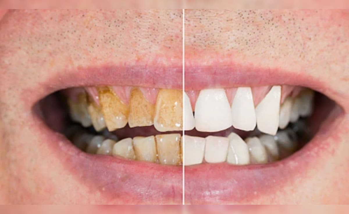 Latest and Breaking News on NDTV Latest and Breaking News on NDTV