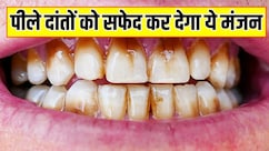 पीले दांतों को सफेद बना देगा ये दंत मंजन, आयुर्वेदिक डॉक्टर सलीम जैदी ने बताया बस 10 मिनट में बनाने का तरीका