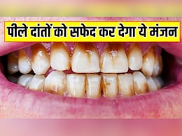 पीले दांतों को सफेद बना देगा ये दंत मंजन, आयुर्वेदिक डॉक्टर सलीम जैदी ने बताया बस 10 मिनट में बनाने का तरीका