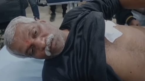 सीने में गोली, फिर भी नहीं टूटा हौसला: 60 साल के चपरासी ने हमलावर से छीना कट्टा, उखाड़ द&zwj;िया नकली पैर