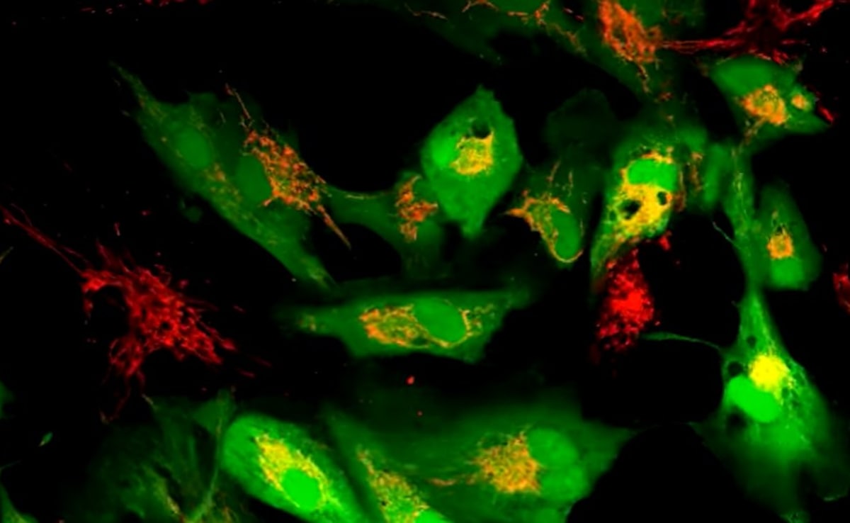 Scientists Discover Method To Revive Ageing Human Cells By Boosting Mitochondria