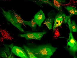 Scientists Discover Method To Revive Ageing Human Cells By Boosting Mitochondria