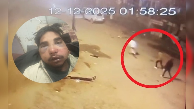 ऐसे भी होती है मौत! बेटे को गुंडों ने पीटा, हालत देख पिता को आ गया हार्ट अटैक