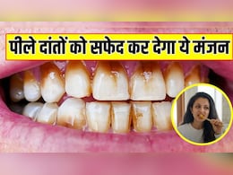 15 दिनों में सफेद हो जाएंगे पीले दांत, हेल्थ कोच ने बताया बस घर पर बनाकर लगा लें ये सस्ता पाउडर